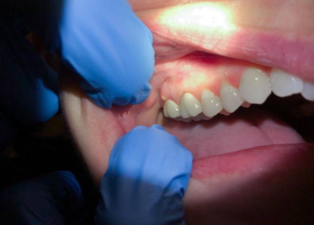 Best Weekend Emergency Dentist in Pinedale, WY
