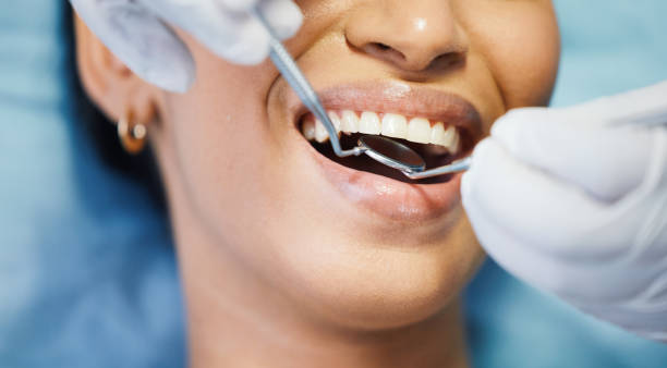 Best Emergency Tooth Extraction in Pinedale, WY