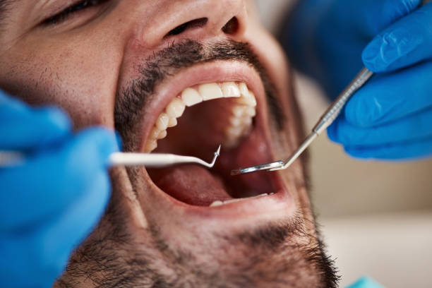 Reliable WY Emergency Dentist Solutions